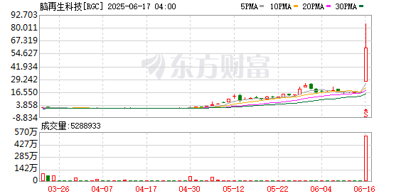 恒捷配资 美股脑机接口概念被热炒：零营收公司一夜暴涨283% 关键芯片临床实验此前获批